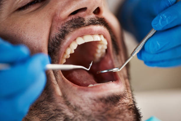 Best Emergency Treatment for Dental Infections or Abscesses in Helena West Helena, AR